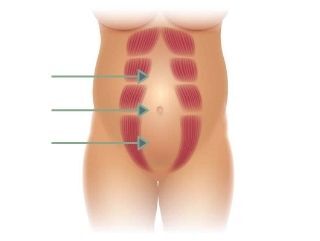Diastasis Recti: How To Know If You Have It – Mommy Matters